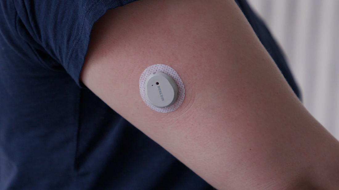 lexcam dexcom g7 stelo waterproof patches